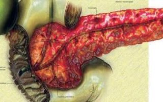 Осложнения и последствия хронического панкреатита