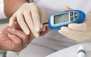Зуд кожи при сахарном диабете лечение