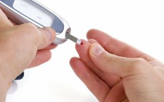 Сахарный диабет 2 стадии лечение