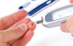 Первые признаки сахарного диабета у женщин и причины развития патологии