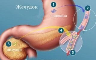 Терапия сахарного диабета в израиле