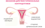 Профилактика нежелательной беременности при диабете – лучшие средства защиты