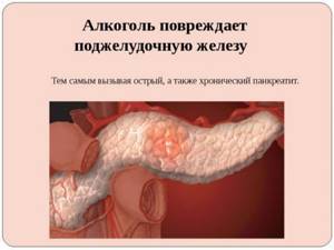 Симптомы болезней поджелудочной железы у мужчин