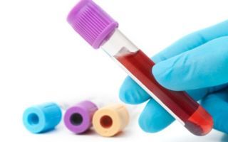 Анализы крови при панкреатите