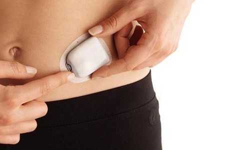 Инсулиновая помпа: отзывы диабетиков про аппарат