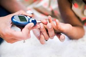 Как начинается сахарный диабет признаки
