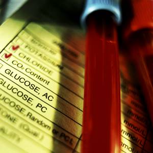 Подтверждение диагноза – тест на диабет