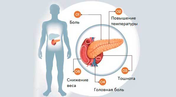 Какой орган вырабатывает инсулин? Функции поджелудочной железы, причины нарушения работы органа