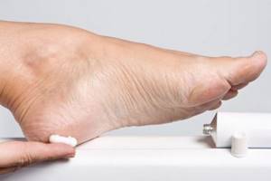 Ампутация ноги при сахарном диабете