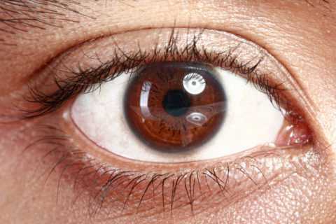 Диабетическая ретинопатия – причины, суть патологии, лечение