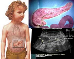 Изменение размеров поджелудочной железы у детей – норма или патология