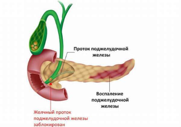 Аюрведа для лечения поджелудочной железы