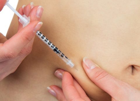 Инсулиновая липодистрофия при сахарном диабете