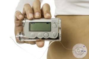 Инсулинозависимый диабет признаки, симптомы, лечение