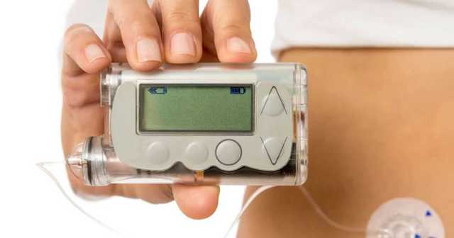 Инсулиновая помпа для диабетиков