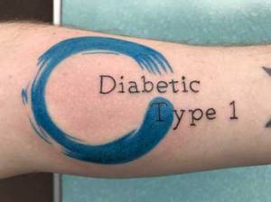 Возможность делать татуировки при диабете