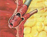 Описание, анатомия и патологии сфинктера Одди