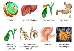 Классификация видов и форм острого панкреатита