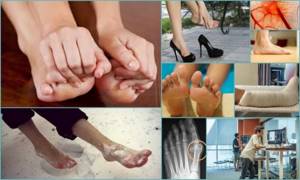 Почему часто проявляется онемение рук и ног при сахарном диабете?
