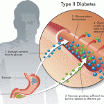 Какой уровень сахара в крови при диабете