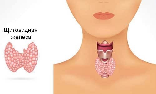 Что такое первичный гипотиреоз щитовидной железы и как лечить заболевание?