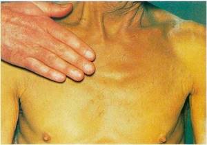 Высыпания на коже при болезнях поджелудочной железы