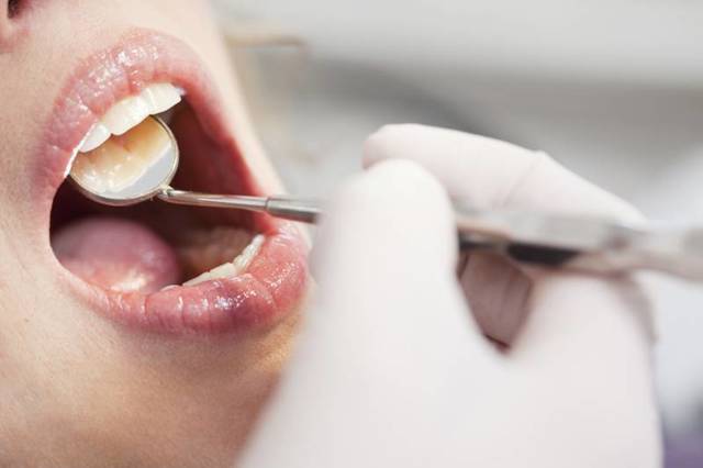 Как проявляется сахарный диабет в полости рта