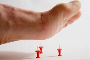 Опухание ног при диабете: причины и методы борьбы с отечностью