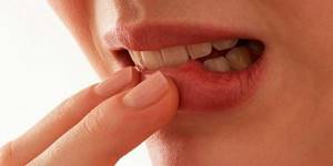 Сухость губ и рта при сахарном диабете